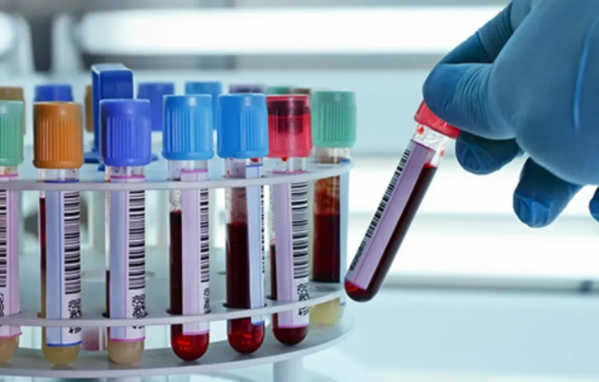 National HIV Statistics and Infection Routes
